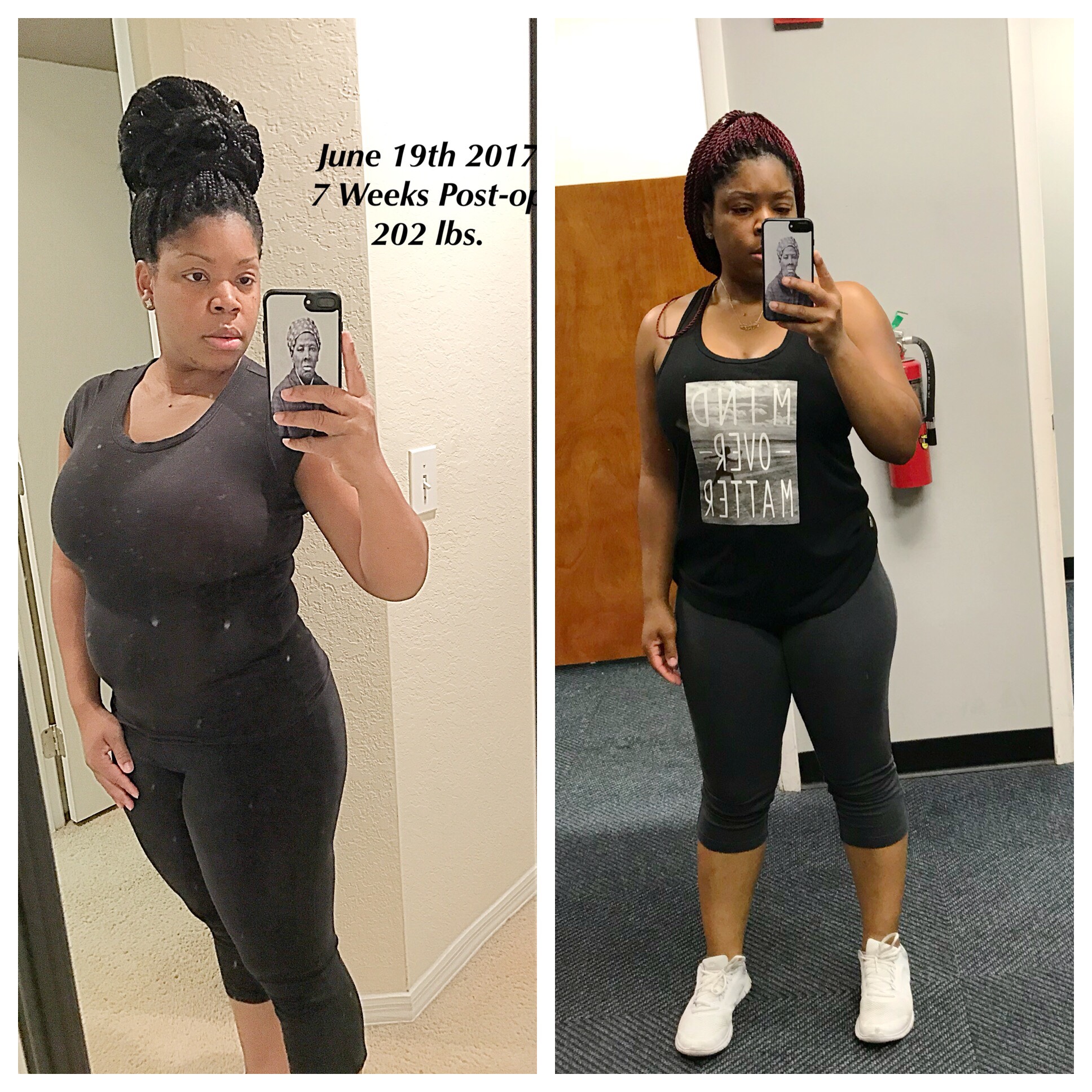 Shakayla #weightlossbeforeandafter #weightlosstransformation #weightlosstips