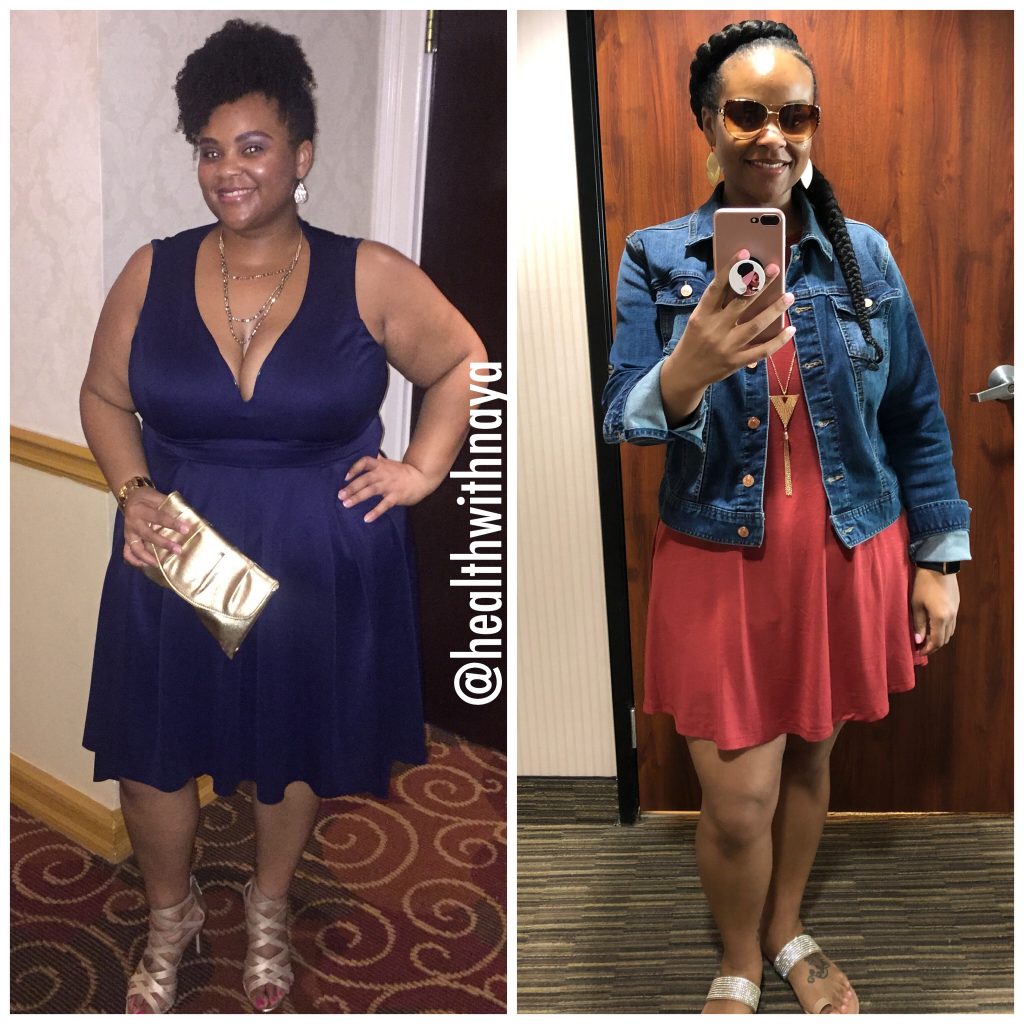 Sinaya Cotlong #weightlossbeforeandafter #weightlosstransformation #weightlosstips #blackwomenweightloss #weightlosssuccess
